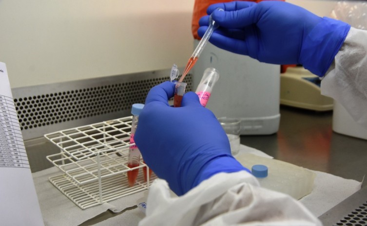 Com identificação de novas variantes no país, SES-TO solicita ampliação da testagem - Foto: Nielcem Fernandes/Governo do Tocantins