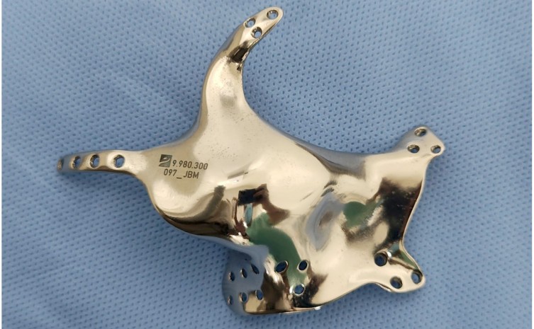 HGP realizou implante inédito no rosto de um paciente - Foto: Saúde/Governo do Tocantins