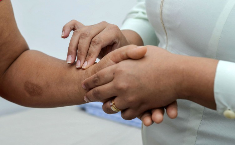 Janeiro Roxo chama a atenção para a doença que teve 698 casos diagnosticados no Tocantins, em 2022 - Foto: Raiza Milhomem/Governo do Tocantins