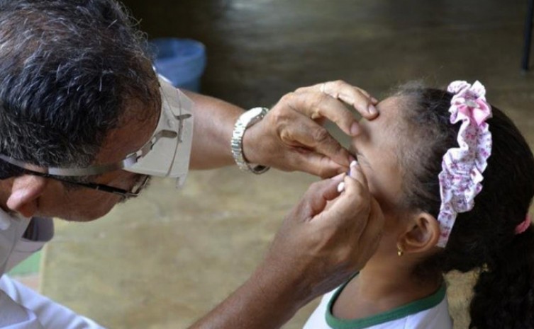 Tracoma é considerado uma doença crônica e atinge em sua maioria crianças em idade escolar - Foto: SES/Governo do Tocantins