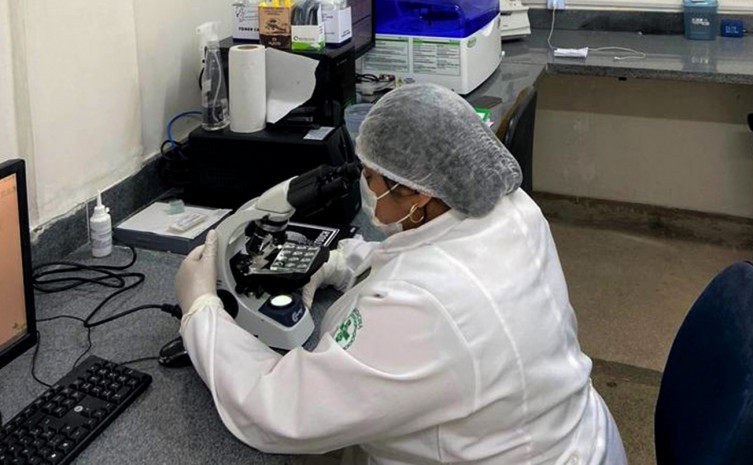 SES-TO garante que todos os hospitais estaduais tenham serviços laboratoriais - Foto: SES/Governo do Tocantins