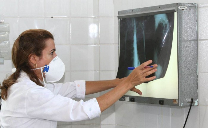 Brasil ocupa o 17º lugar entre os 22 países responsáveis por 82% do total de casos de tuberculose no mundo - Foto: Divulgação